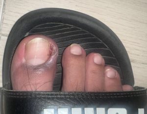 Foto-antes