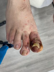 una-complicada